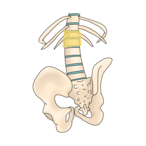 Thoracolumbar for Jaimi
