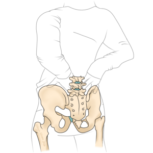 Lower Back Pain [Blog Post Kit]